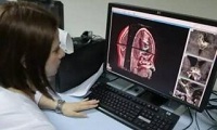 数百万数据库，武汉兰丁医疗的宫颈癌筛查病理机器人Landing已获多国临床认证